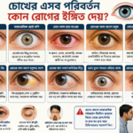 চোখ ফুলে যাওয়ার কারণ